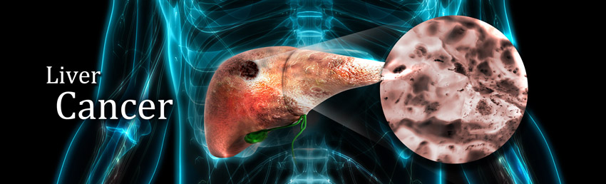 Liver Cancer Tumor Markers